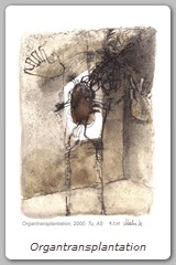 Organtransplantation